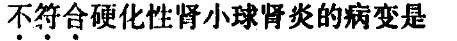 西医综合,模拟考试,《西医综合》模拟试卷16