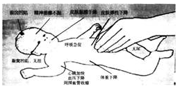 护士资格证,历年真题,2018年护士执业资格考试（实践能力）真题网络版