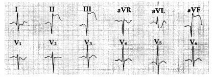 护士资格证,高频错题,实践能力,护士执业资格《实践能力》综合练习7