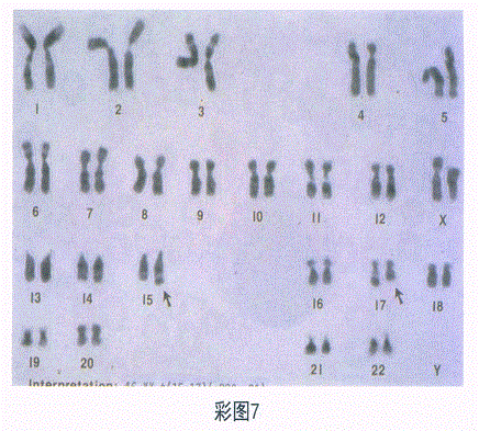 临床医学检验技术（士）,章节练习,临床医学检验技术7