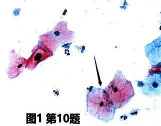 临床医学检验技术（士）,历年真题,2015年临床医学检验技术（士）考试（专业实践能力）真题