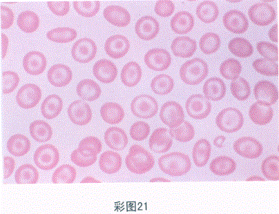 临床医学检验技术（师）,章节练习,临床医学检验技术6