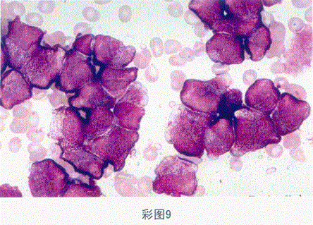临床医学检验技术（师）,章节练习,临床医学检验技术6