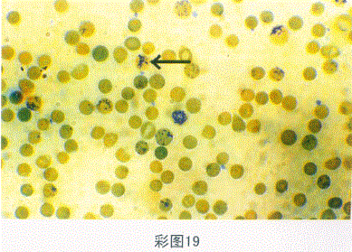 临床医学检验技术（师）,章节练习,临床医学检验技术7