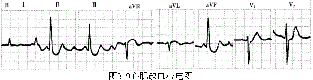 中西医结合执业医师,章节练习,内部冲刺,实践技能