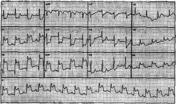 中西医结合执业医师,章节练习,内部冲刺,诊断学基础
