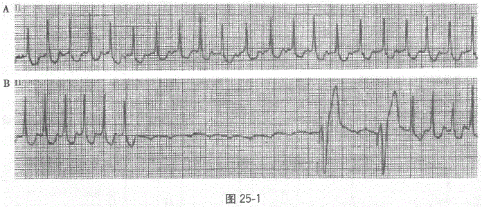 全科医学301,章节练习,基础复习,专业知识,心血管疾病