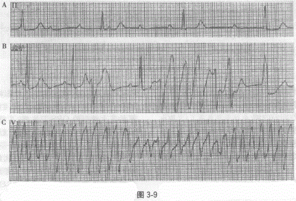 全科医学301,章节练习,基础复习,专业知识,心血管疾病