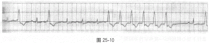 全科医学301,章节练习,基础复习,专业知识,心血管疾病