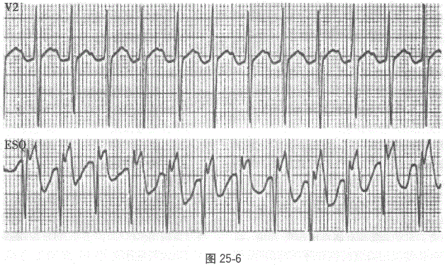 全科医学301,章节练习,基础复习,专业知识,心血管疾病