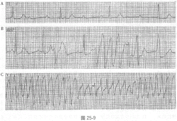 全科医学301,章节练习,基础复习,专业知识,心血管疾病