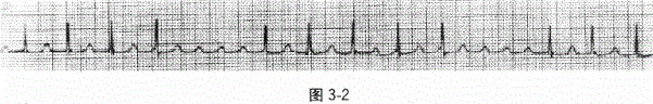 全科医学301,章节练习,基础复习,专业知识,心血管疾病