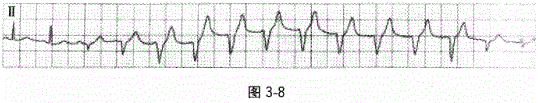 全科医学301,章节练习,基础复习,专业知识,心血管疾病