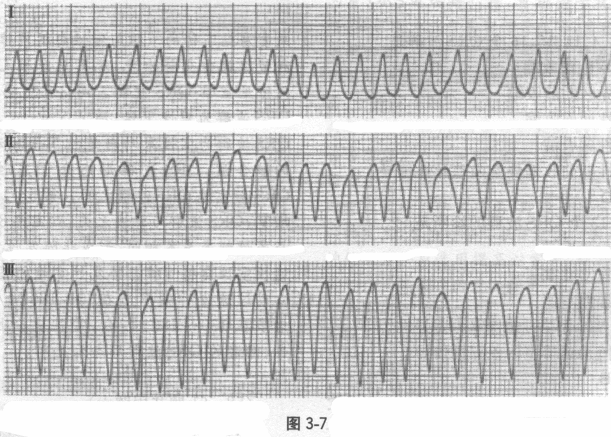 全科医学301,章节练习,内部冲刺,专业知识