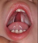 口腔医学353,章节练习,基础复习,口腔颌面外科学