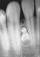 口腔医学353,章节练习,基础复习,口腔颌面外科学