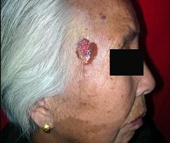 口腔医学353,章节练习,基础复习,口腔颌面外科学