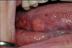 口腔医学353,章节练习,基础复习,口腔颌面外科学