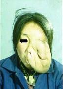 口腔医学353,章节练习,基础复习,口腔颌面外科学