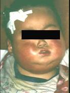 口腔医学353,章节练习,基础复习,口腔颌面外科学