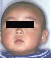 口腔医学353,章节练习,基础复习,口腔颌面外科学