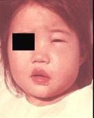 口腔医学353,章节练习,基础复习,口腔颌面外科学