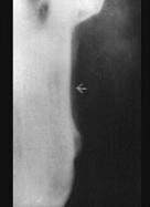 口腔医学353,章节练习,基础复习,口腔颌面外科学