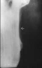 口腔医学353,章节练习,基础复习,口腔颌面外科学 口腔医学353,章节练习,基础复习,口腔颌面外科学