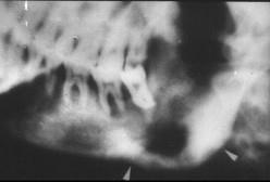 口腔医学353,章节练习,基础复习,口腔颌面外科学 口腔医学353,章节练习,基础复习,口腔颌面外科学