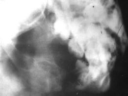 口腔医学353,章节练习,基础复习,口腔颌面外科学 口腔医学353,章节练习,基础复习,口腔颌面外科学