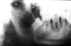 口腔医学353,章节练习,基础复习,口腔颌面外科学 口腔医学353,章节练习,基础复习,口腔颌面外科学