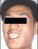 口腔医学353,章节练习,基础复习,口腔颌面外科学