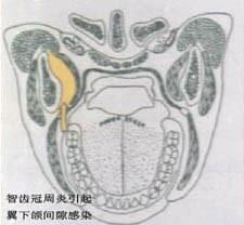 口腔医学353,章节练习,基础复习,口腔颌面外科学