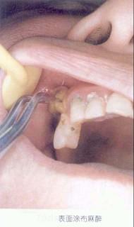 口腔医学353,章节练习,基础复习,口腔颌面外科学