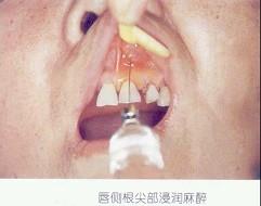 口腔医学353,章节练习,基础复习,口腔颌面外科学