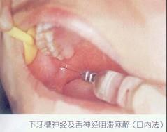 口腔医学353,章节练习,基础复习,口腔颌面外科学