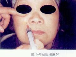 口腔医学353,章节练习,基础复习,口腔颌面外科学 口腔医学353,章节练习,基础复习,口腔颌面外科学