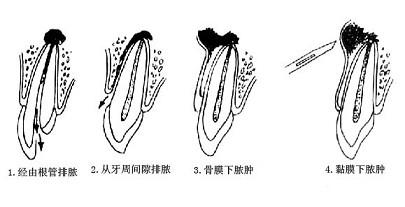 口腔内科354,章节练习,口腔内科学