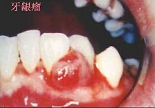 口腔内科354,章节练习,口腔内科学
