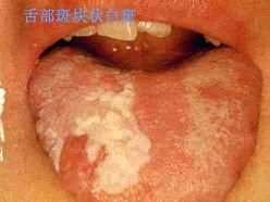 口腔内科354,章节练习,口腔内科学