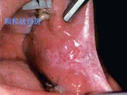 口腔内科354,章节练习,口腔内科学