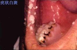 口腔内科354,章节练习,口腔内科学