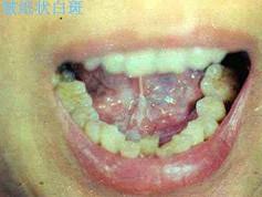口腔内科354,章节练习,口腔内科学