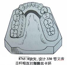 口腔内科354,章节练习,口腔修复学