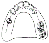 口腔内科354,章节练习,口腔修复学