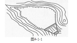 安全实务金属非金属矿山安全,章节练习,基础复习,尾矿库安全技术