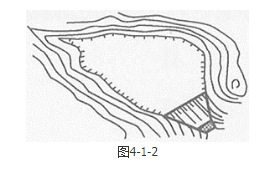 安全实务金属非金属矿山安全,章节练习,基础复习,尾矿库安全技术