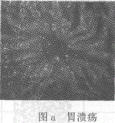 卫生招聘（病理学汇总）,章节练习,基础复习,病理学专业