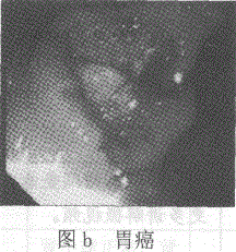 卫生招聘（病理学汇总）,章节练习,基础复习,病理学专业