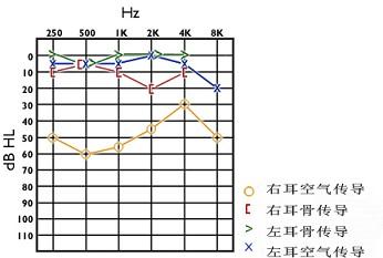 卫生招聘（耳鼻喉科汇总）,章节练习,基础复习,耳科学